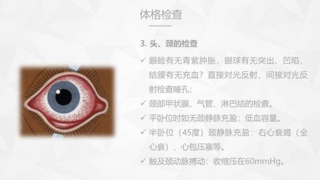 薄荷绿扁平化风格危重症病人的护理PPT模板5