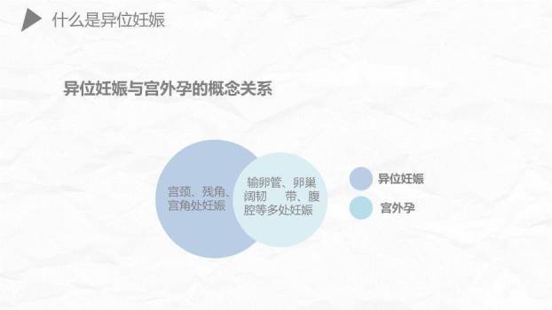 薄荷绿简约风异位妊娠护理PPT模板4