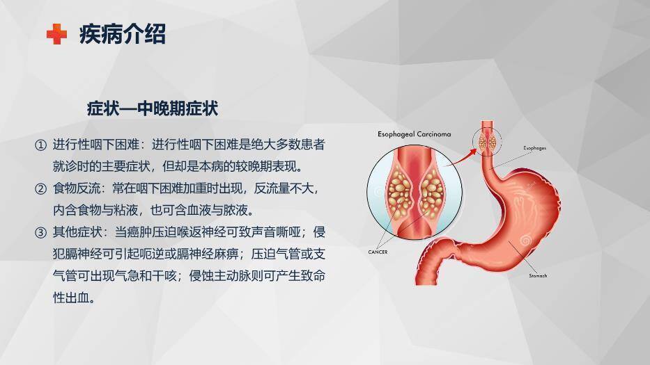 藏青色商务风食管癌的护理查房PPT模板1