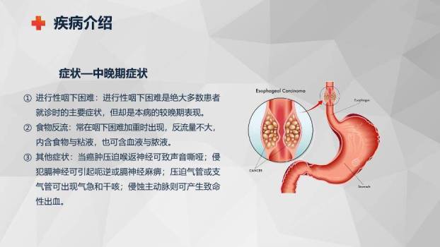 藏青色商务风食管癌的护理查房PPT模板1