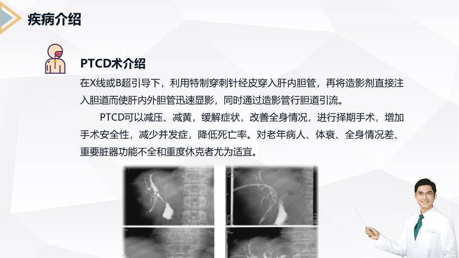 藏青色商务风胰腺癌患者护理查房PPT模板2