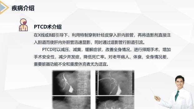 藏青色商务风胰腺癌患者护理查房PPT模板2