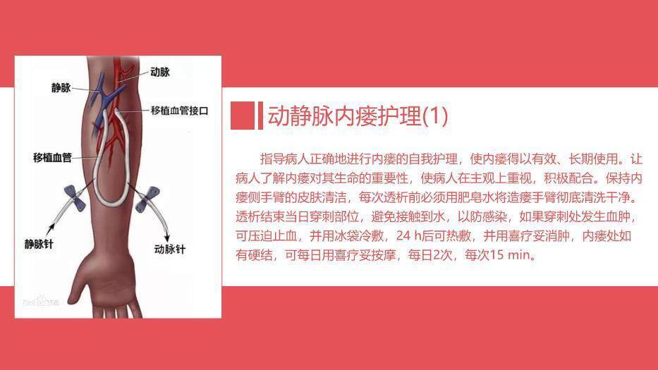 红色血透病人的护理PPT模板6
