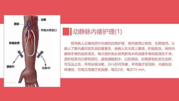 红色血透病人的护理PPT模板6