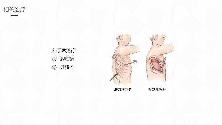 黄色插画风结核性胸膜炎护理业务学习课件PPT模板9