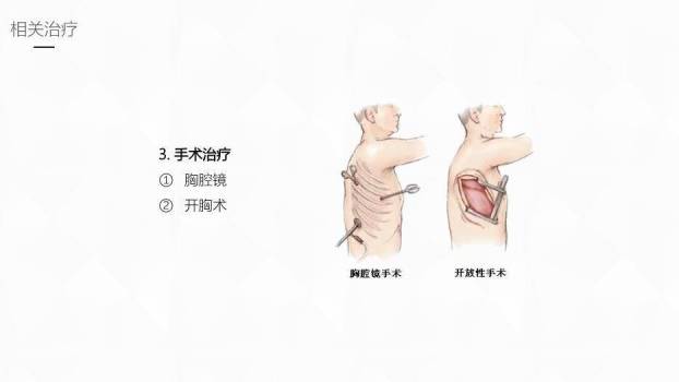 黄色插画风结核性胸膜炎护理业务学习课件PPT模板9