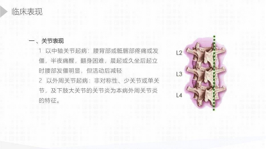 黄色插画风强直性脊柱炎护理查房PPT模板1