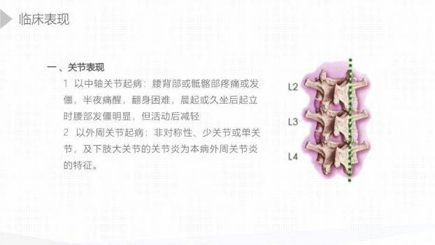 黄色插画风强直性脊柱炎护理查房PPT模板1
