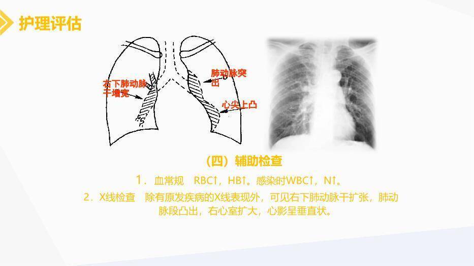 黄色插画慢性肺源性心脏病患者的护理PPT模板7