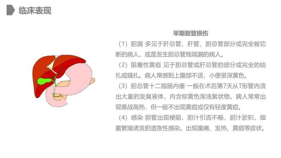 灰色卡通风胆道损伤的护理PPT模板1