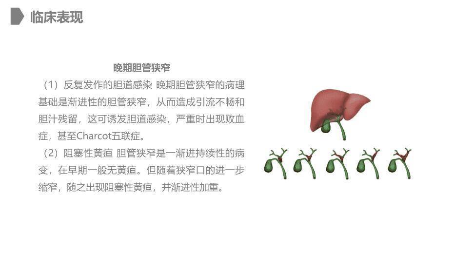 灰色卡通风胆道损伤的护理PPT模板2