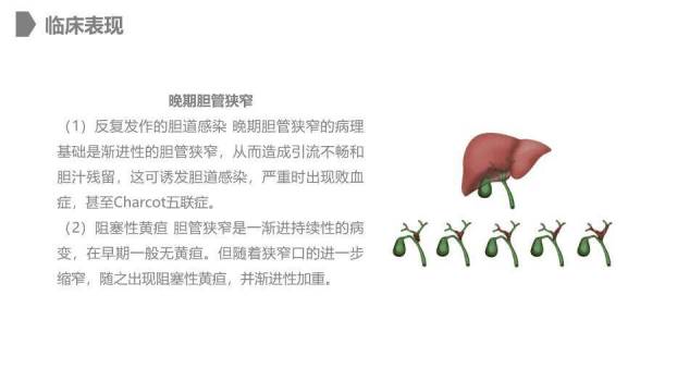 灰色卡通风胆道损伤的护理PPT模板2