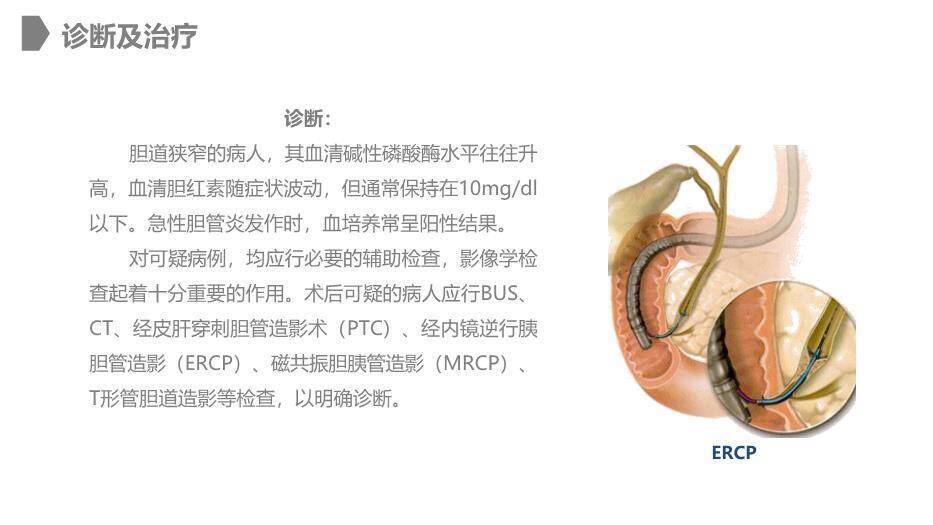 灰色卡通风胆道损伤的护理PPT模板4