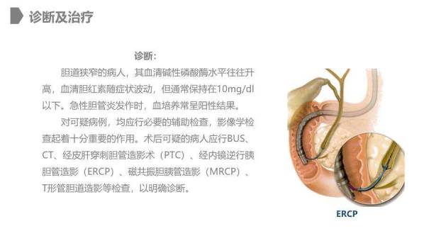 灰色卡通风胆道损伤的护理PPT模板4