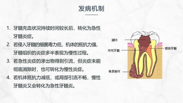 灰色商务风牙髓炎的护理查房PPT模板1
