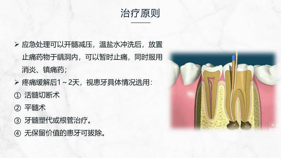 灰色商务风牙髓炎的护理查房PPT模板5