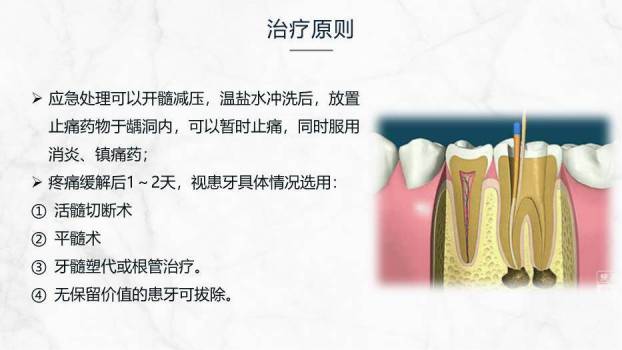 灰色商务风牙髓炎的护理查房PPT模板5