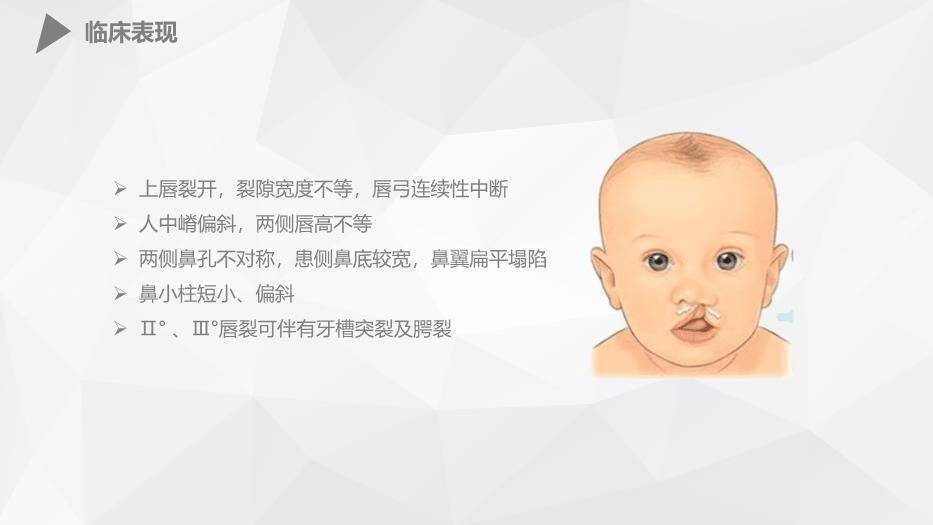 橘色插画风幼儿唇裂的护理查房PPT模板1
