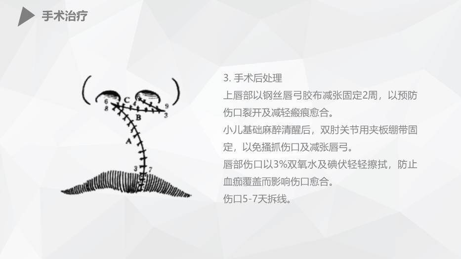 橘色插画风幼儿唇裂的护理查房PPT模板4