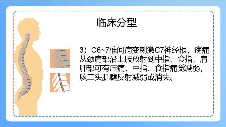 蓝色插画风颈椎病病人的护理PPT模板1