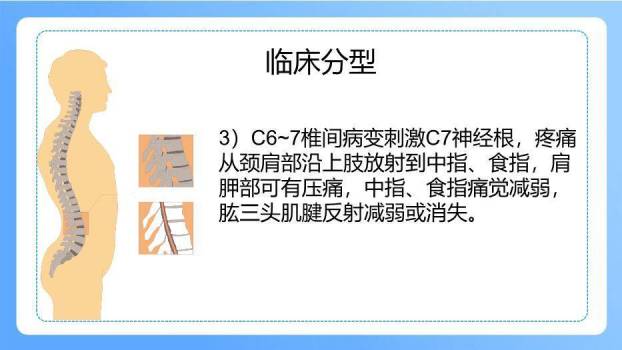 蓝色插画风颈椎病病人的护理PPT模板1