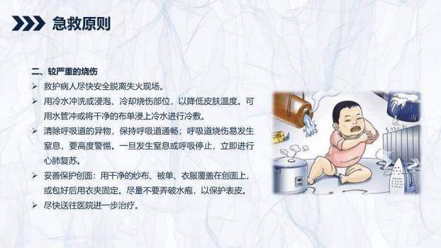 蓝色简约风烧伤患者护理查房PPT模板5