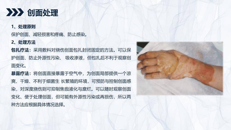 蓝色简约风烧伤患者护理查房PPT模板7