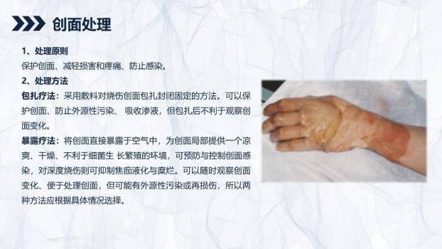 蓝色简约风烧伤患者护理查房PPT模板7