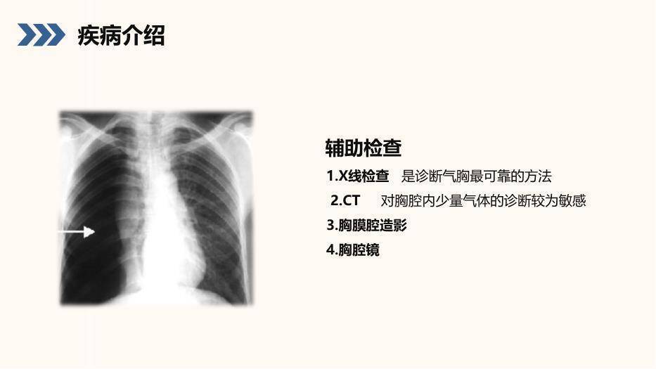 蓝色小清新风结核性胸膜炎患者护理查房PPT模板2