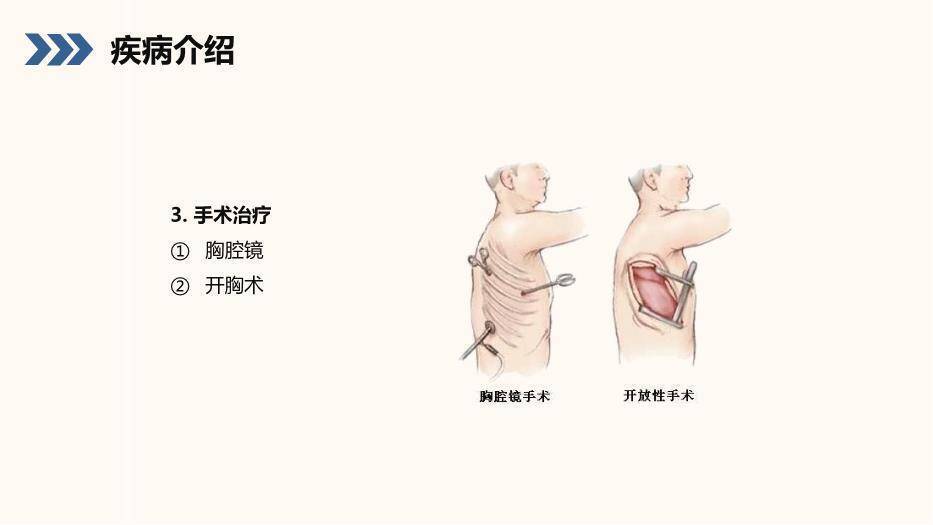 蓝色小清新风结核性胸膜炎患者护理查房PPT模板4