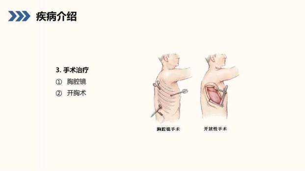 蓝色小清新风结核性胸膜炎患者护理查房PPT模板4
