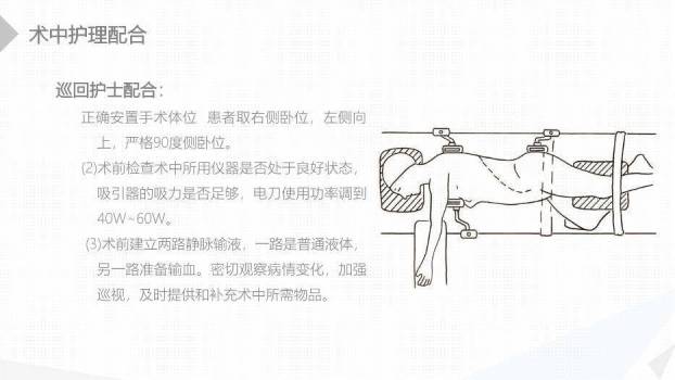 绿色扁平化风格经前路腰椎手术的综合护理PPT模板1