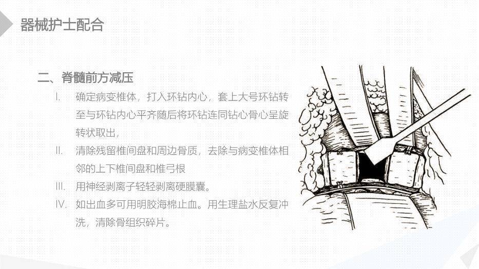 绿色扁平化风格经前路腰椎手术的综合护理PPT模板3