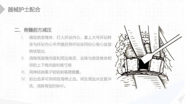 绿色扁平化风格经前路腰椎手术的综合护理PPT模板3