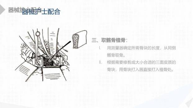绿色扁平化风格经前路腰椎手术的综合护理PPT模板4