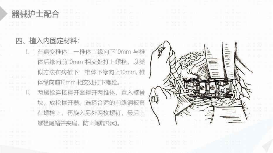 绿色扁平化风格经前路腰椎手术的综合护理PPT模板5
