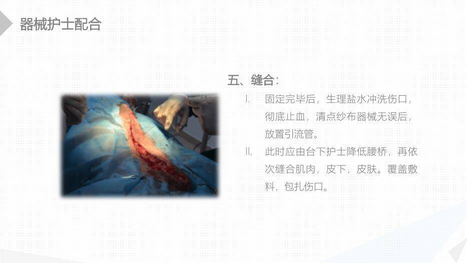 绿色扁平化风格经前路腰椎手术的综合护理PPT模板6