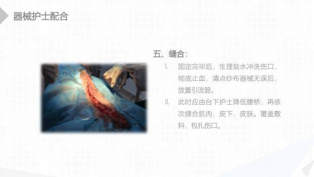 绿色扁平化风格经前路腰椎手术的综合护理PPT模板6