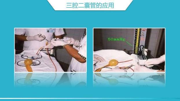 绿色科技医疗风消化道出血护理PPT模板7