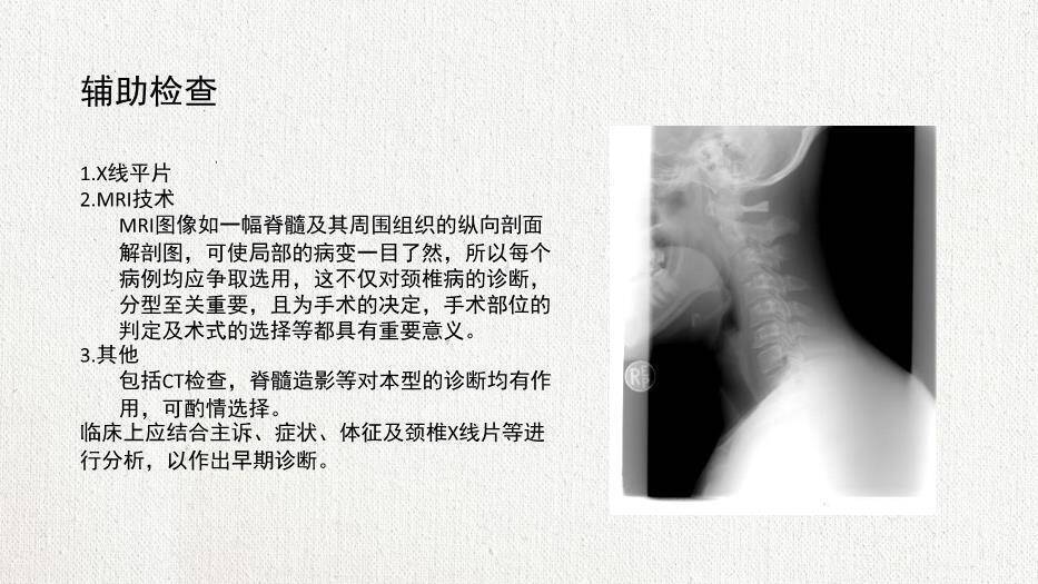 米黄色极简风脊髓型颈椎病患者的个案护理查房PPT模板1