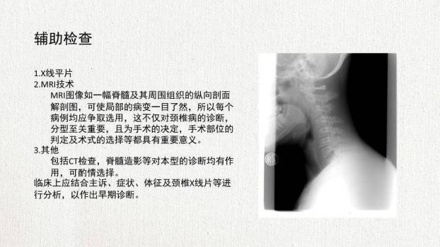 米黄色极简风脊髓型颈椎病患者的个案护理查房PPT模板1