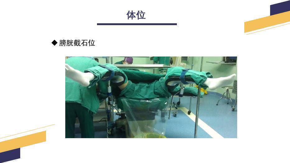 黄色几何风经尿道前列腺电切手术配合PPT模板2