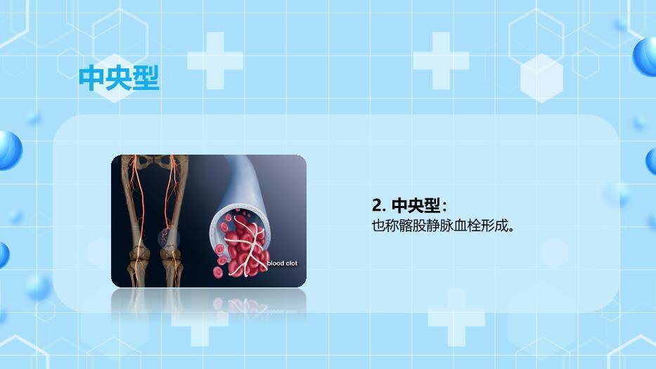 蓝色卡通插画风下肢静脉血栓的护理查房PPT模板8