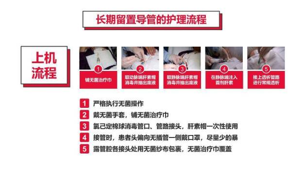 红色血液透析留置导管护理PPT模板2