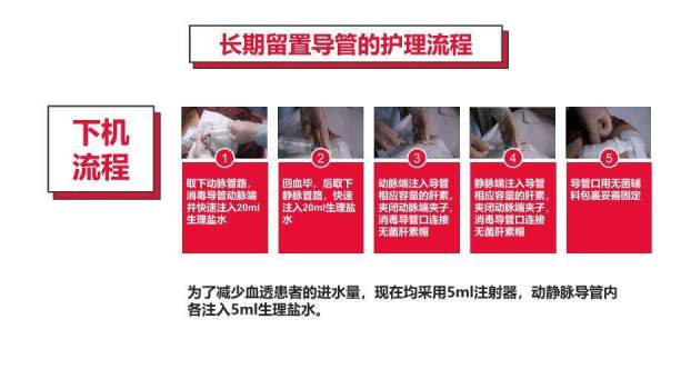红色血液透析留置导管护理PPT模板4