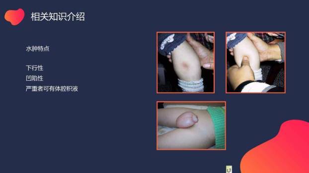 蓝色极简渐变风小儿肾病综合症的护理PPT模板7