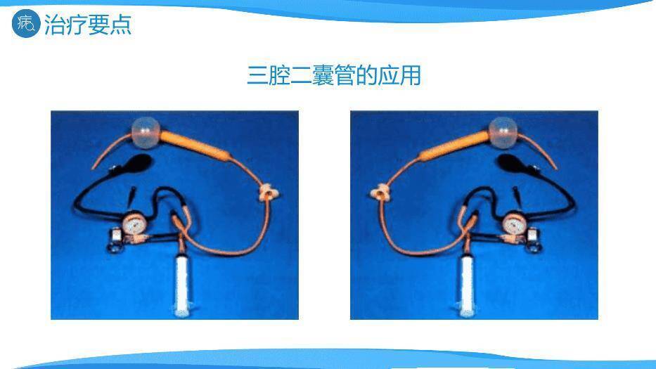 天蓝色微立体消化道出血护理PPT模板7